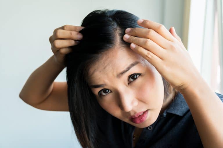 5 Treatments To Prevent And Treat Hair Loss In Singapore